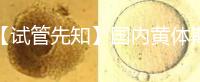 【試管先知】國內(nèi)黃體期方案經(jīng)驗緊缺,2點促排弊端需了解