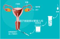 縱隔子宮能做試管嬰兒嗎?醫(yī)生:可以做,但要手術(shù)治療再進(jìn)周