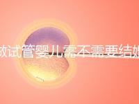 做試管嬰兒需不需要結(jié)婚證,試管嬰兒需要提給結(jié)婚證嗎?