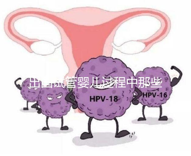 出國試管嬰兒過程中那些困惑，12個常見問題釋疑