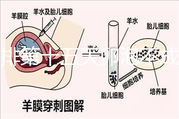 促排第十五天卵泡不成熟還可以治療!1.2等幾天就能長大