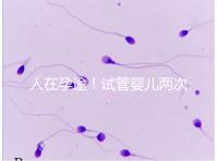 人在孕途！試管嬰兒兩次胎停育,了解這幾招能降低流產(chǎn)風(fēng)險(xiǎn)