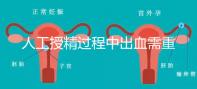 人工授精過程中出血需重視!這3種情況會影響成功率