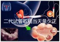 二代試管取精當天量少正不正常60s弄清，不造怎么辦速覽