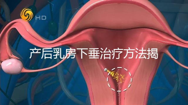 產后乳房下垂治療方法揭秘，按摩手法再好也沒提前預防有用