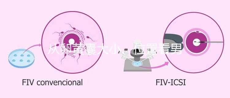 從卵黃囊大小、位置看男女，寶寶性別分辨一眼就準