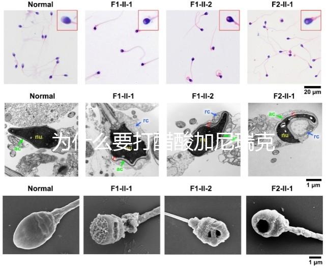 為什么要打醋酸加尼瑞克?試管拮抗劑方案的“穩(wěn)定劑”