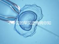 不罕見的罕見遺傳病你知道嗎？帶你認識下特納綜合癥