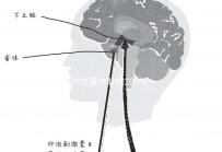 三代試管并非能100%杜絕甲亢!成功率大不大看所選醫院