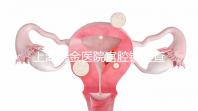 上海瑞金醫(yī)院宮腔鏡檢查多少錢?專家:流程簡(jiǎn)單性價(jià)比高