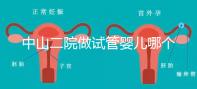 中山二院做試管嬰兒哪個醫(yī)生好？附醫(yī)院試管成功率