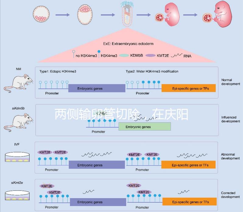 兩側輸卵管切除,在慶陽有醫(yī)院能做試管嬰兒嗎?