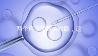 兩個月寶寶竟成對眼，這5大形成原因家長必知