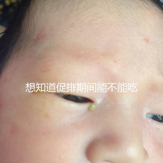 想知道促排期間能不能吃草莓看過來，怎么吃不發胖有講究