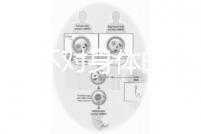 揭秘上環(huán)對身體的5大壞處,女人別再無知了