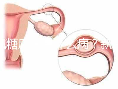 楓糖尿病是什么?。啃律鷥哼@5個指標偏低要注意了