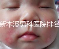 更新本溪男科醫(yī)院排名，不要錯(cuò)過(guò)本溪湖區(qū)top3醫(yī)生的專業(yè)