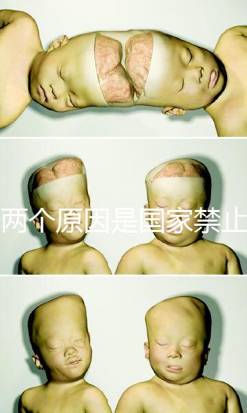 有兩個原因是國家禁止中非混血中國會接受嗎？