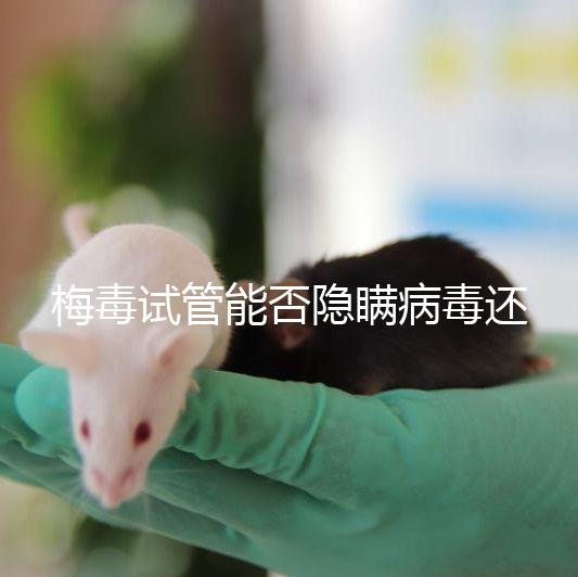 梅毒試管能否隱瞞病毒還沒有建造，備案記錄已經(jīng)通知