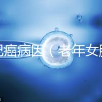 淋巴癌病因(老年女腋下淋巴癌病因)