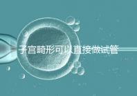 子宮畸形可以直接做試管嬰兒？醫生說，應先治療！