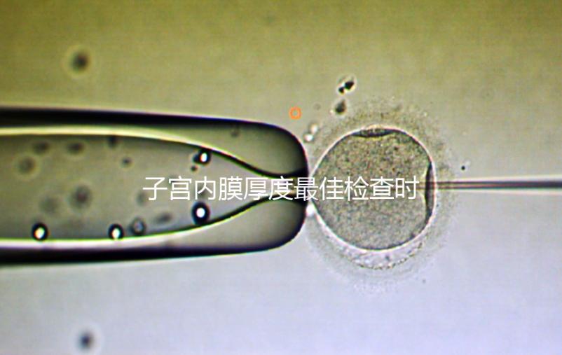 子宮內(nèi)膜厚度最佳檢查時期，你有必要提前知道！