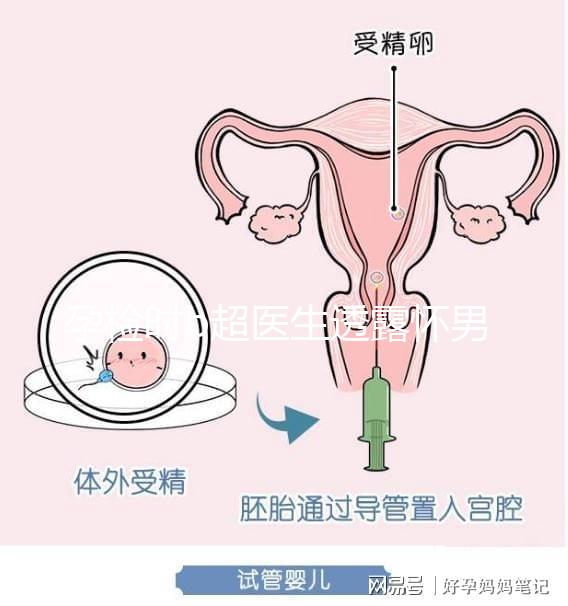 孕檢時b超醫(yī)生透露懷男寶女寶暗語寶典，一語戳中有心人！