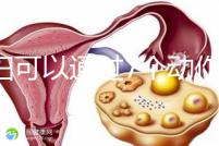 孕婦可以通過7個動作緩解坐骨神經(jīng)痛，并按摩一篇文章來解釋