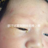 宿遷試管醫院排名榜上哪家好，不造助孕成功率和費用別亂選