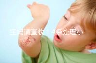 寶媽請(qǐng)查收!4條處理小妙招教你如何緩解新生兒吐奶