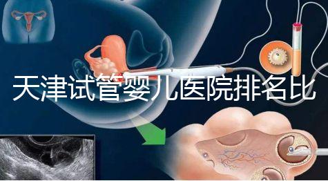 天津試管嬰兒醫(yī)院排名比較好
