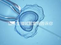 山大生殖試管案例告訴你,歷經3個月后懷孕辛酸史