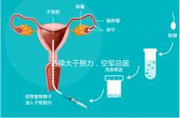 選擇大于努力，空軍總醫院做試管嬰兒必讀攻略