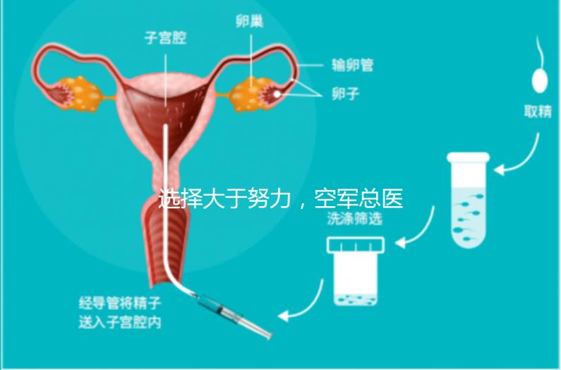 選擇大于努力，空軍總醫院做試管嬰兒必讀攻略