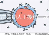 重慶婦幼人工授精一次成功率揭秘,移植費(fèi)用貴有原因