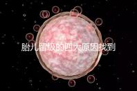 胎兒留級的四大原因找到了!多半和媽媽太懶不運動有關(guān)系