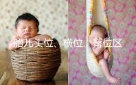 胎兒頭位、橫位、臀位區別大，5個方面教你分辨