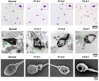 西華做試管嬰兒費(fèi)用-西華醫(yī)院試管嬰兒花費(fèi)明細(xì)表