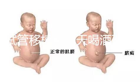 試管移植前幾天喝酒了有影響嗎？想要懷孕得管住嘴！