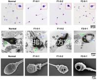 試管促排卵不同方案都適合哪些人?如何監測排卵?