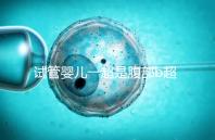 試管嬰兒一超是腹部b超還是陰超要早知,二者區(qū)別大請(qǐng)注意