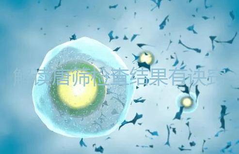 解讀唐篩檢查結(jié)果有訣竅,會(huì)看報(bào)告單上的正常值范圍是關(guān)鍵