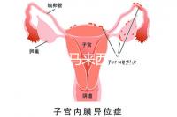還在糾結(jié)馬來(lái)西亞試管嬰兒醫(yī)院怎么選擇?讀完這篇文章,不困難