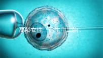 高齡女性“追生”二胎，做試管嬰兒有哪些好處？