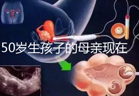 50歲生孩子的母親現在過得真不怎么樣，大齡不建議沖三胎