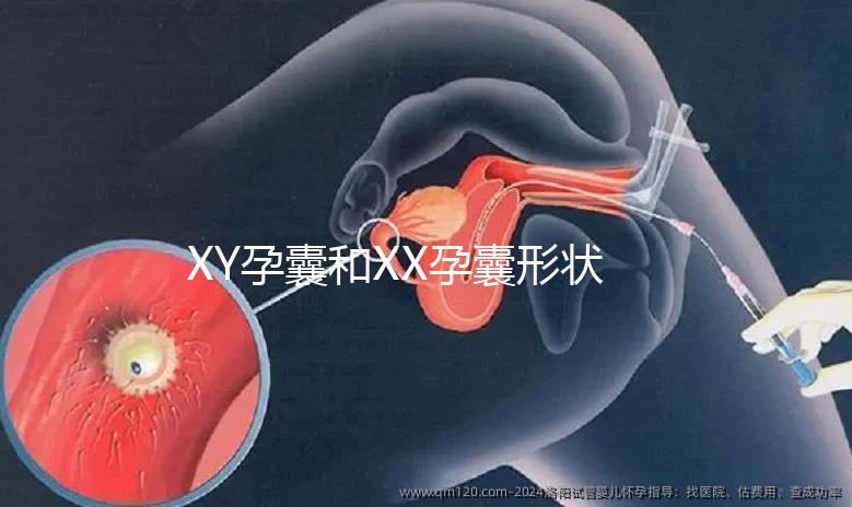 XY孕囊和XX孕囊形狀各有差異，橢圓形可能是懷女哦！