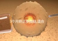 3個(gè)月矯正羅圈腿,適合成年人的變直雙腿的鍛煉方法