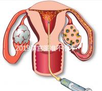2019清宮圖準(zhǔn)不準(zhǔn)不知道,但檢測(cè)生男女這3種方法才科學(xué)