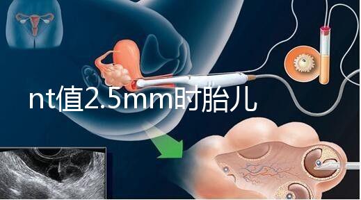 nt值2.5mm時胎兒異常幾率并不高，但羊水穿刺一定要做