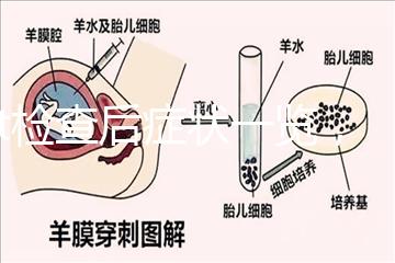 tct檢查后癥狀一覽，專家提醒做好處理措施是關鍵